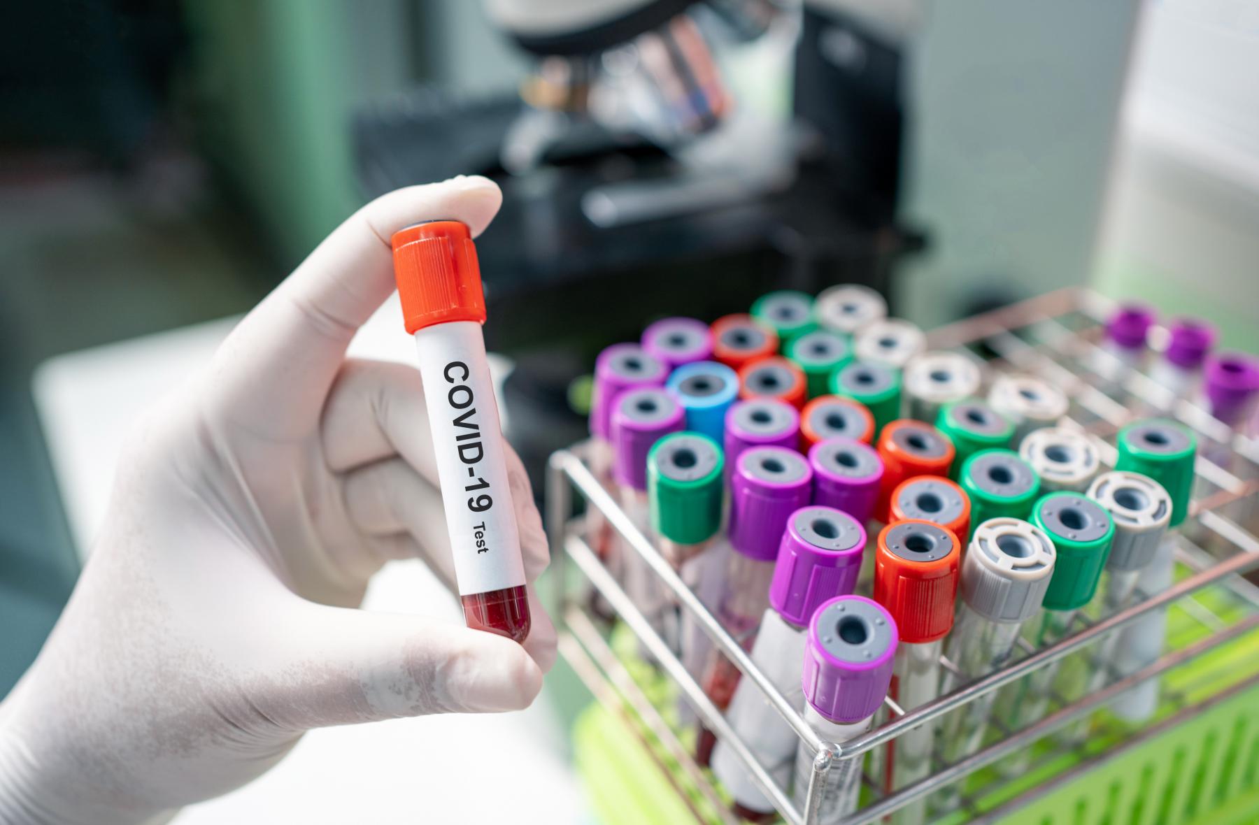 68 people now infected from one Covid outbreak started in a restaurant 