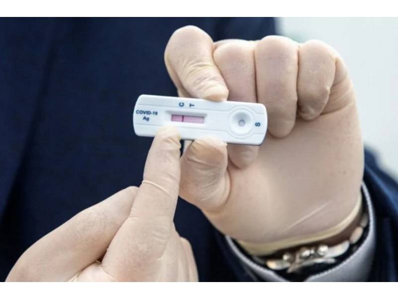 You can now buy Antigen tests in chemists from only 7 euros in the Canaries