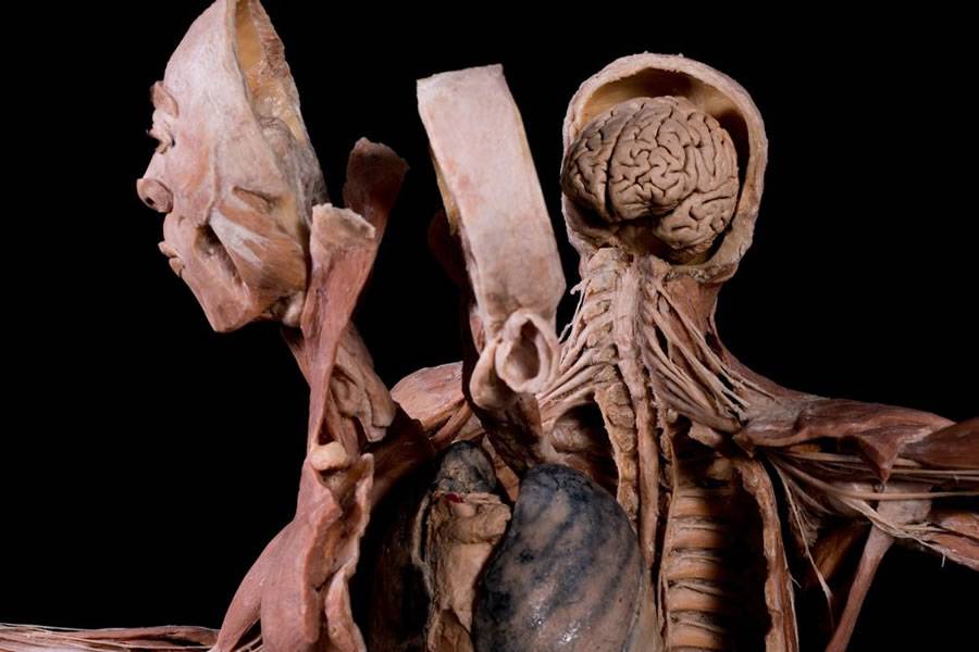 'Bodies' the world-famous exhibition of real human bodies comes to Tenerife