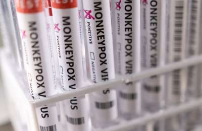 Spain will study containment measures to stop Monkeypox