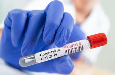 Covid update: 1,029 new cases and 7 seven deaths since Saturday