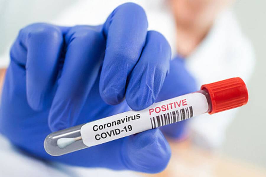Covid update: 1,029 new cases and 7 seven deaths since Saturday