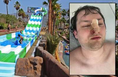 British tourist wants €1,500 compensation after breaking his nose at water park in Tenerife