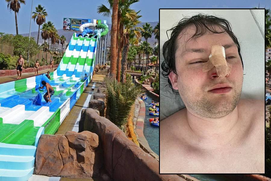 British tourist wants €1,500 compensation after breaking his nose at water park in Tenerife British tourist wants €1,500 compensation after breaking his nose at water park in Tenerife