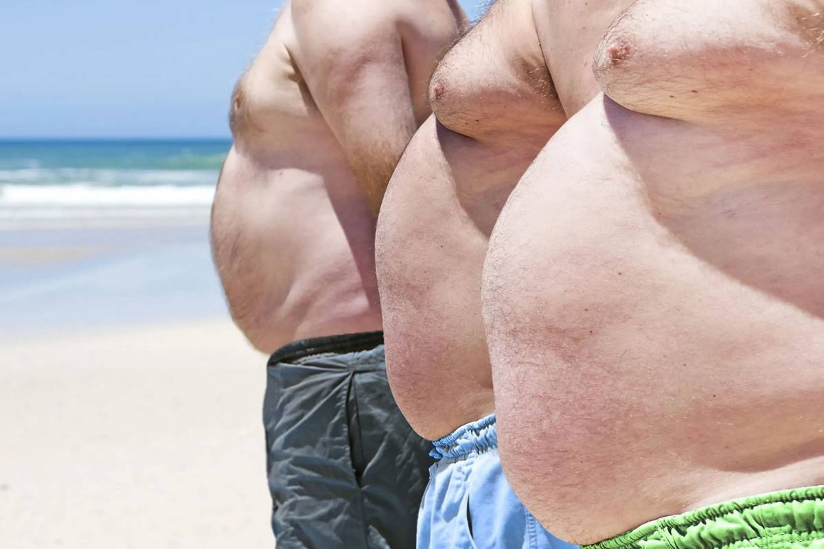 Obesity rates surge in the Canary Islands, ranking second highest in Spain