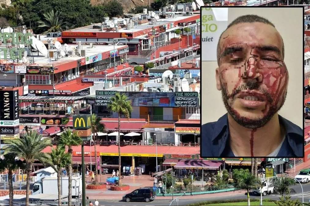 Brutal assault on business owner in Puerto Rico shopping centre