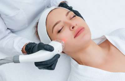 8 Benefits of AviClear Laser for Acne-Free Skin