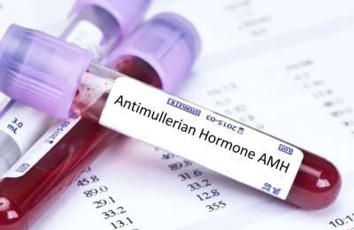 5 Essential Things to Get Ready in Your AMH Blood Test
