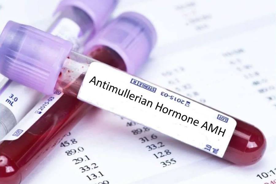 5 Essential Things to Get Ready in Your AMH Blood Test