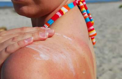 Health authorities warn of unusually high UV Radiation risk in the Canary Islands