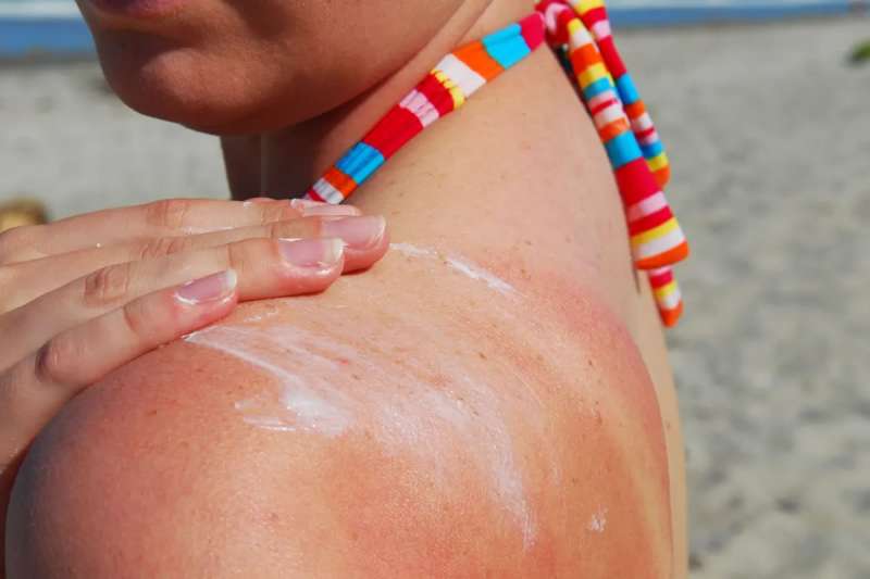 Health authorities warn of unusually high UV Radiation risk in the Canary Islands