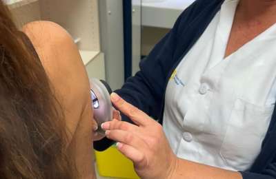 The Health Service introduces 1,400 devices for early skin cancer detection 