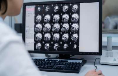 Comprehensive Guide to Modern Brain Cancer Treatments: Options, Innovations & Hope