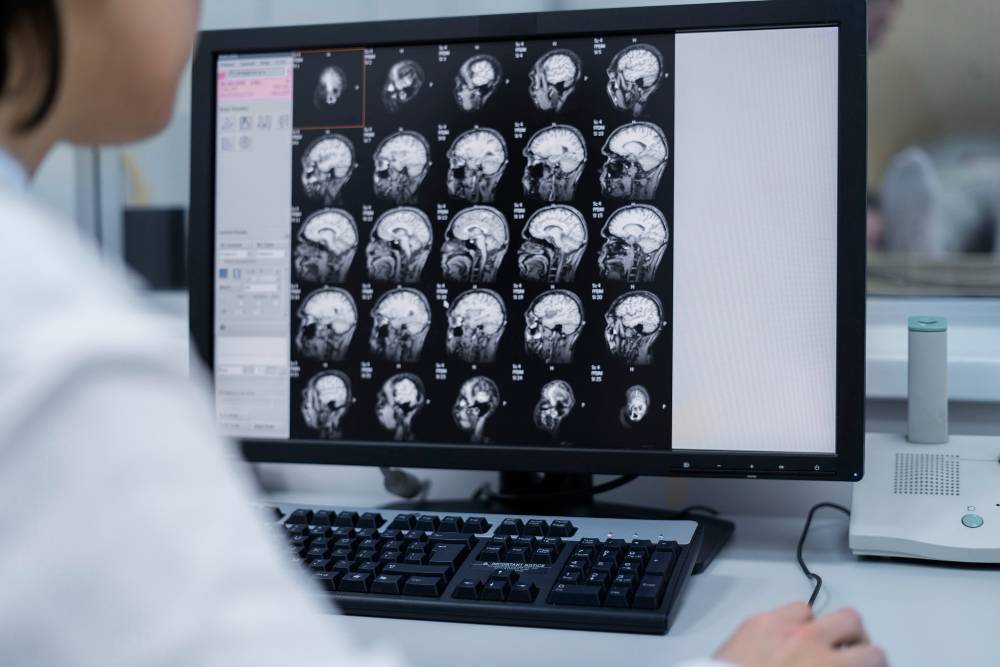 Comprehensive Guide to Modern Brain Cancer Treatments: Options, Innovations & Hope