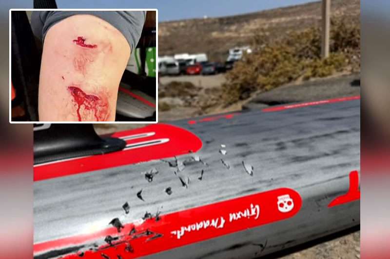 Shark Attacks Paddleboarder off the Coast of Fuerteventura