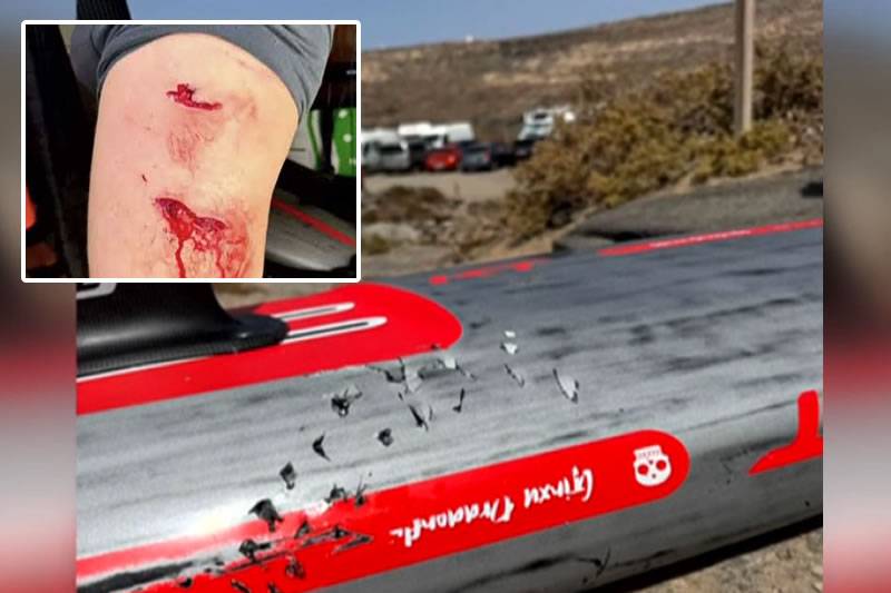 Shark Attacks Paddleboarder off the Coast of Fuerteventura