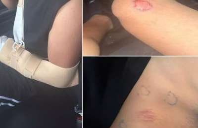 Teenager brutally beaten by group of five in Gran Canaria